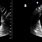 Bladder Wall Ultrasound