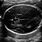 CSP Fetal Ultrasound