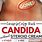 Candida Skin Treatment