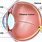 Choroid Eye