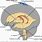 Choroid Plexus Brain