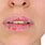 Chronic Chapped Lips