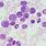 Chronic Myeloid Leukemia Cells