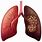 Drawing of Lung Cancer
