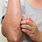 Eczema Rash On Arms