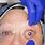Eye Implant Surgery