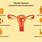 Fibroid Tumors