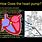 Heart Pump Diagram