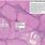 Histology of Liver Cirrhosis