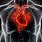 Human Heart Disease