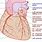 Left Anterior Coronary Artery