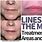 Lines around Mouth Treatment