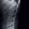Lumbar Spine X-ray Views
