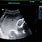 Meconium in Amniotic Fluid Ultrasound