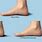 Normal Foot Arch