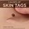 Normal Skin Tags