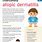 Pediatric Atopic Dermatitis