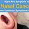 Pictures of Nasal Cancer