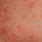 Pictures of Skin Rashes