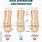 Pronation vs Supination Feet