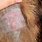 Pyoderma Dog Skin Infection