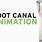Root Canal Animation