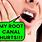 Root Canal Tooth Pain