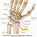 Scaphoid Bone in Wrist