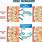 Spinal Surgery Types