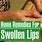Swollen Lip Remedy