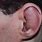 Swollen Outer Ear