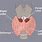 Thyroid Lobes Anatomy