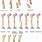 Types of Femoral Fractures