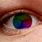 Weird Eye Iris