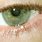 White Cyst On Eyelid