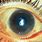 Xerophthalmia Eye