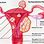 Fibroid Placement in Uterus