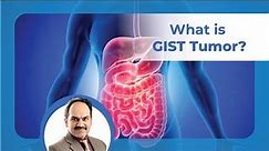 What is GIST? | Gastrointestinal Stromal Tumor | Dr. Anil Kamath | Surgical Oncologist in India
