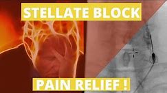 Stellate ganglion Block : Why it helps for Neck and Face Pain