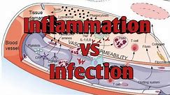 3 Major Differences Between Inflammation and Infection | Inflammation VS Infection