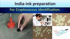 India -ink preparation(Clear overview).