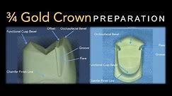 3/4 Gold Crown Preparation | Maxillary Premolar