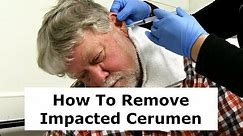 Removing Impacted Cerumen from a Patient's Ear