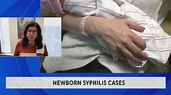 Syphilis cases in newborns on the rise