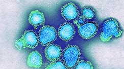 How to deal with the Influenza virus which is spreading across states