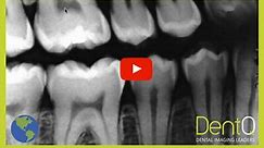 How to Read Dental X-ray?