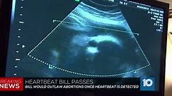 Rape victim couldn't have abortion under new Ohio law