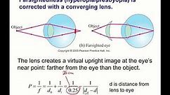 The eye and calculating lens prescriptions