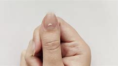 6 reasons why there are white spots on your nails and how to avoid them