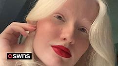 Albino woman has embraced her pale skin and says kids now often mistake her for Elsa from Frozen